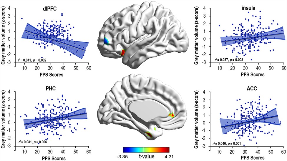 Brain maps and scatter plots for the correlation between the GMVs (z-scores) of significant clusters and the procrastination (PPS scores) in the Sample 1. The sagittal brain maps with both medial and lateral sides located at left hemisphere were mapped to the MNI152 space of the glass brain template. The shadow areas indicated the corresponding 95% CI for the estimated model. Source: Cerem Cortex, Volume 30, Issue 5, May 2020, Pages 2834–2853, https://doi.org/10.1093/cercor/bhz278&thinsp;external link 
